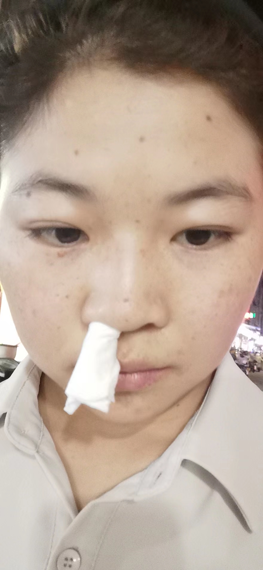 20220816 · 西安 · 流鼻血啦